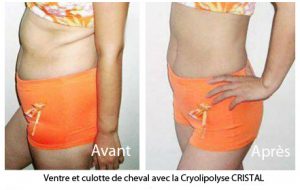 Perdre culotte cheval-cshp