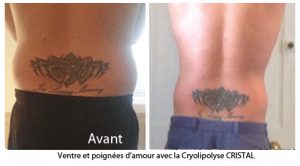 Résultat perdre poignées d'amour-cshp