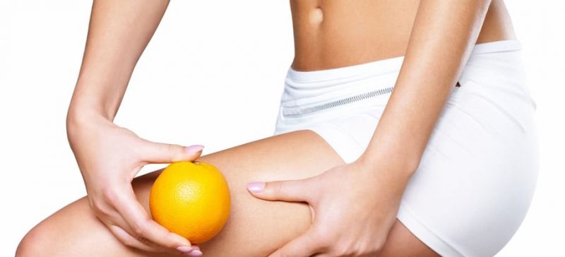 cellulite-cryolipolyse-cshp