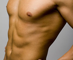 gynecomastie