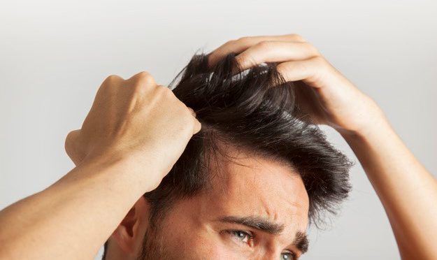 Image : Faire face à la chute de cheveux et dire adieu à la calvitie