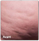 Avap2-cellfina-avant