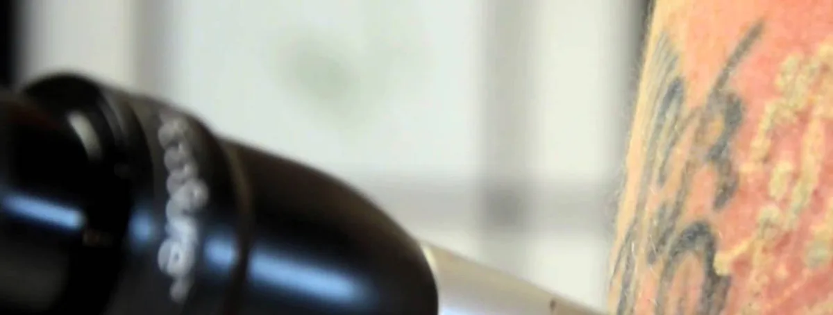 picosure-cshp