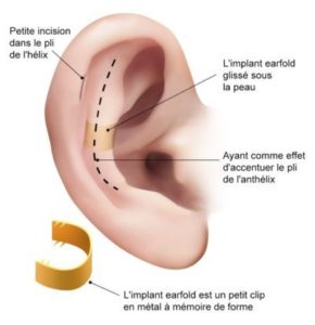 shema earfold