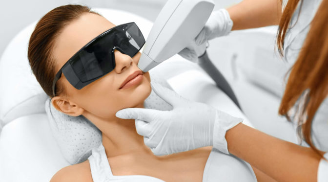 epilation laser