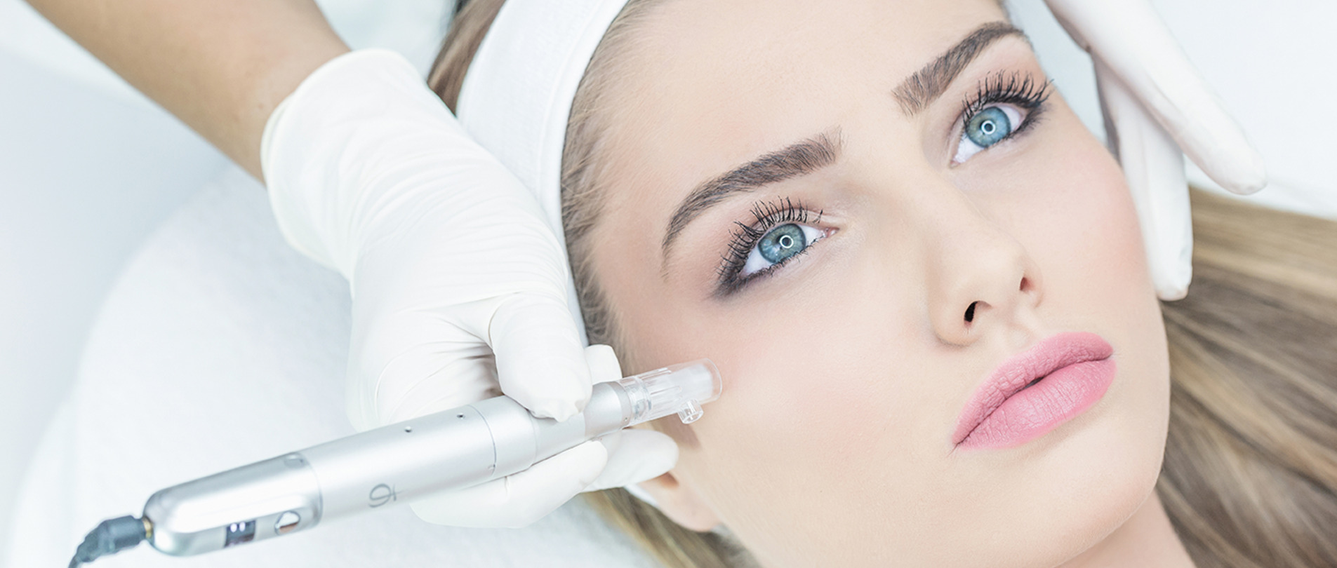 microneedling