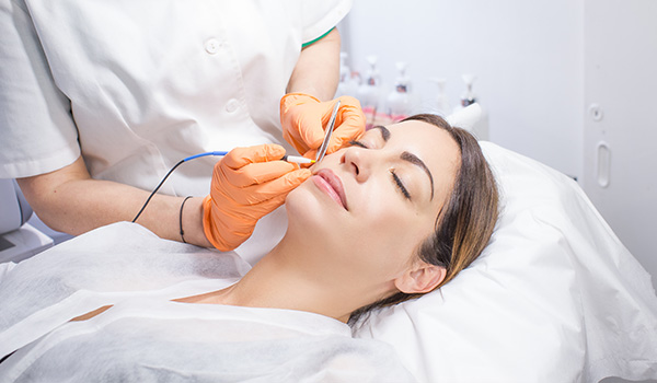 epilation électrique
