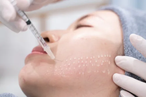 skinboosters