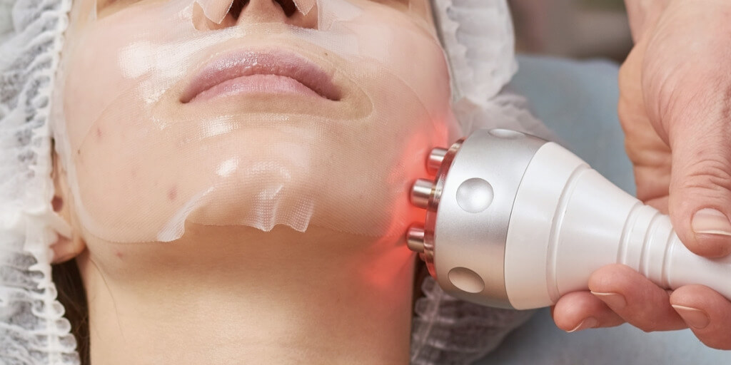 Radiofrequence visage