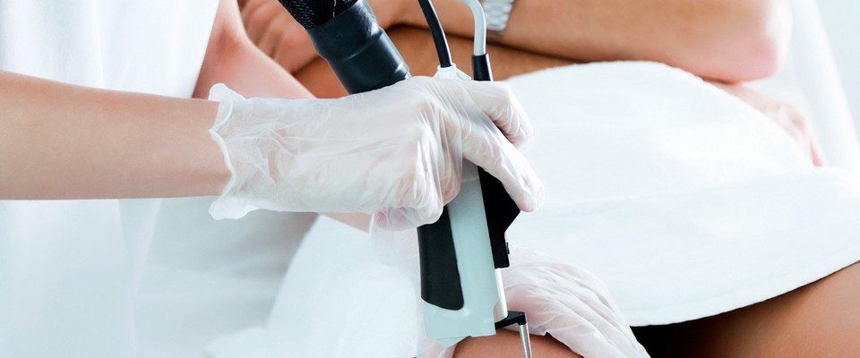 epilation maillot