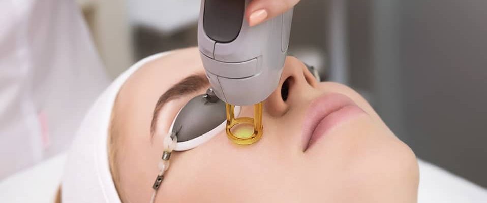 epilation visage