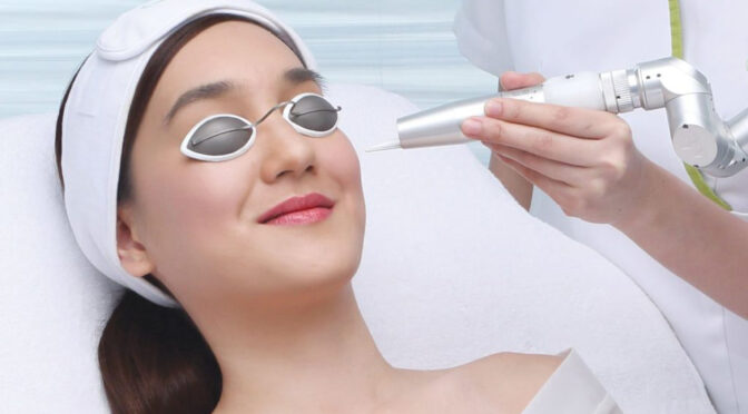 Image : Comment enlever efficacement le duvet du visage chez la femme : méthodes et conseils