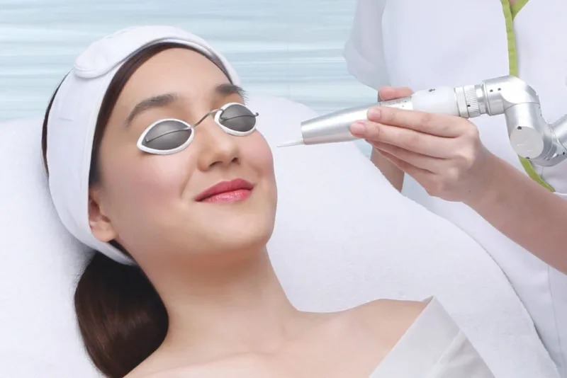 Comment enlever efficacement le duvet du visage chez la femme : méthodes et conseils